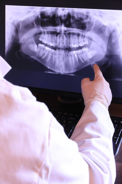 Best Emergency Dentist for Lost Fillings or Crowns in Andrews, NC