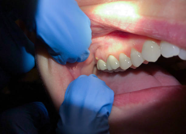 Best Mobile Emergency Dentist in Andrews, NC