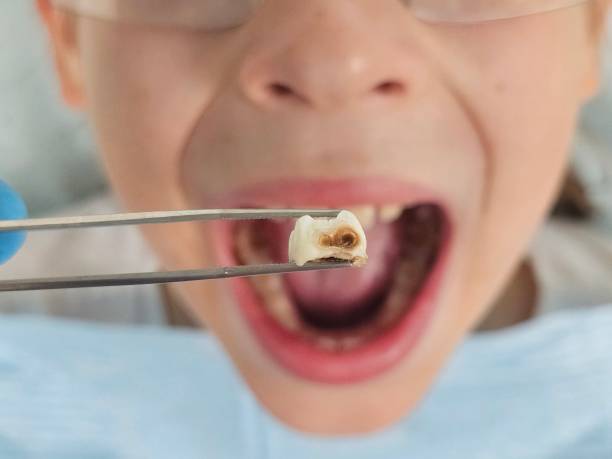 Best Holiday Emergency Dentist in Andrews, NC